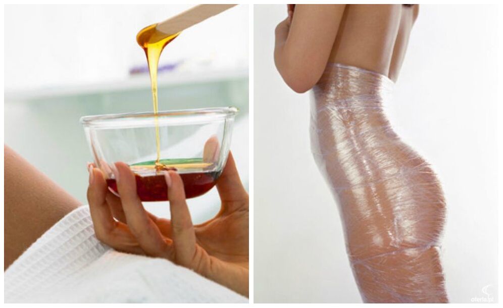 Körperpackungen zur Gewichtsreduktion